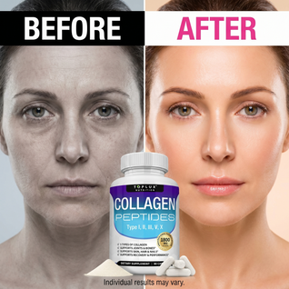Collagen Peptides
