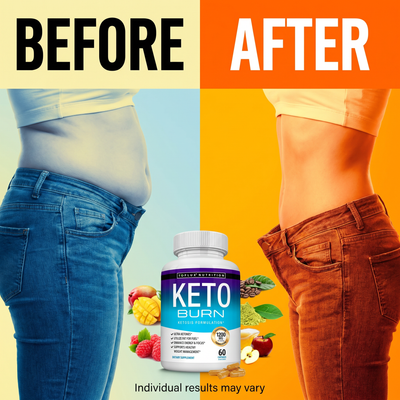 Keto Burn - before_after